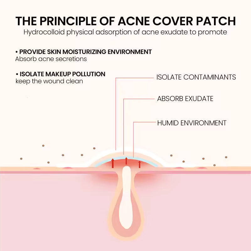 ClearDot™ Acne Patch