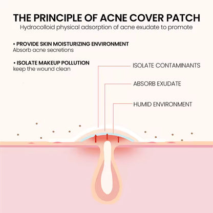 ClearDot™ Acne Patch
