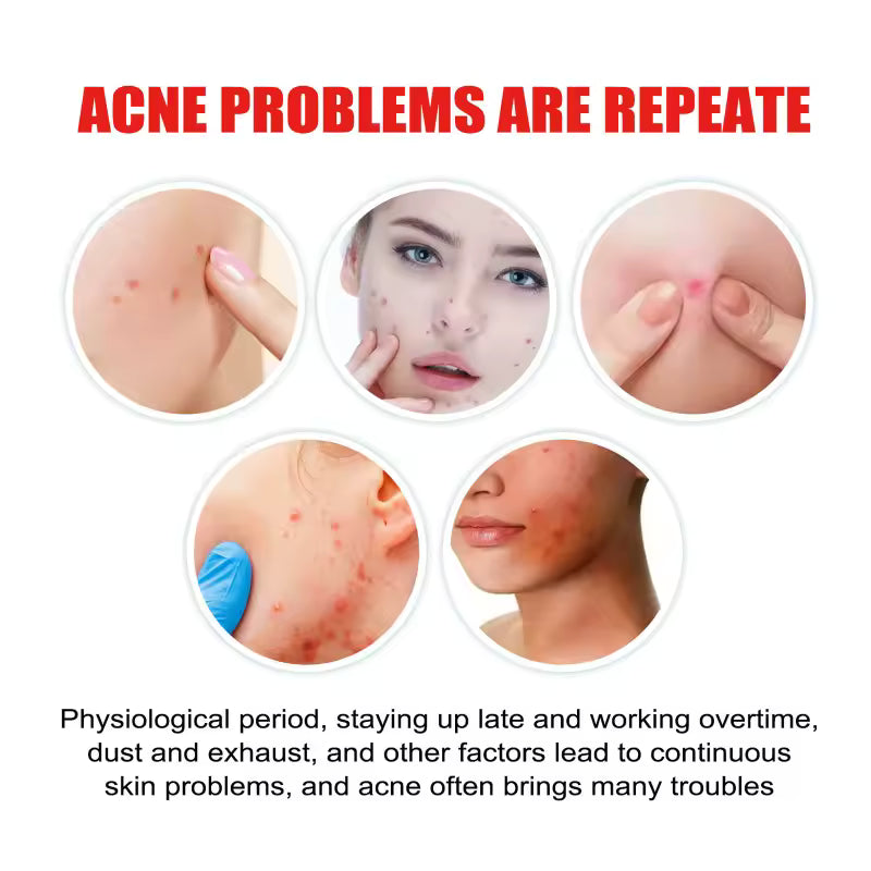ClearDot™ Acne Patch