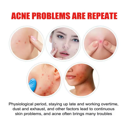 ClearDot™ Acne Patch