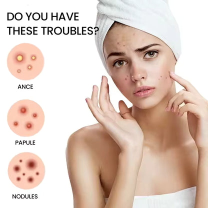 ClearDot™ Acne Patch