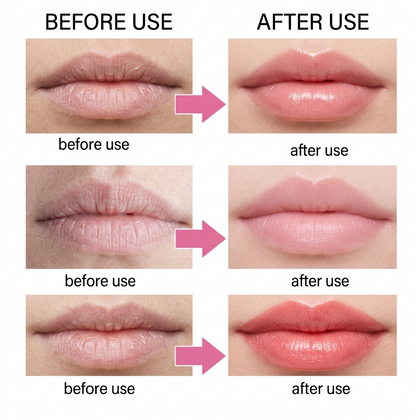 RoseLift™ Collagen Pink Mask