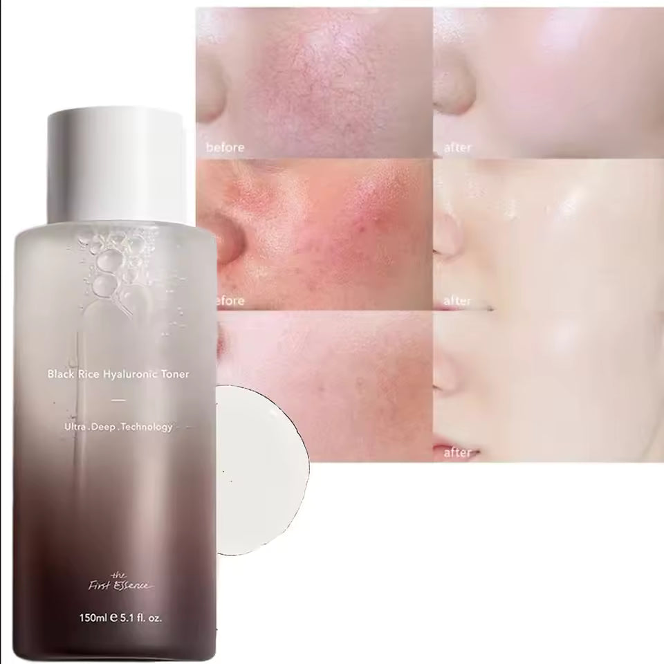 GlowGrain™ Brightening Rice Toner