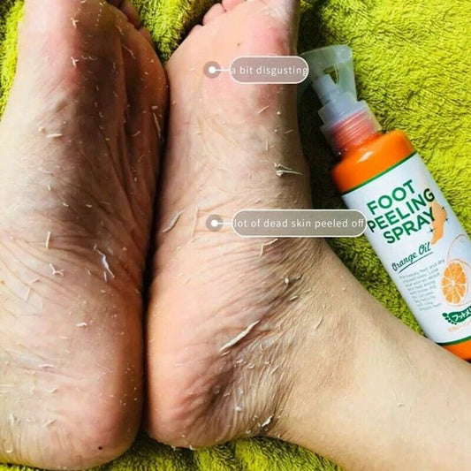 SilkaStep™ Foot Peeling Spray