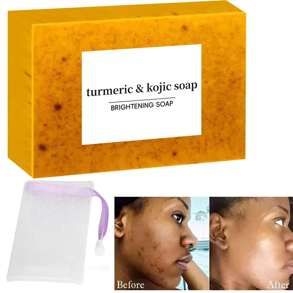 SkinGlow™ Kojic Turmeric Soap Bar