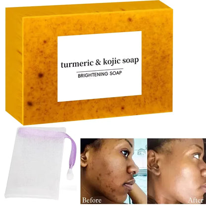 SkinGlow™ Kojic Turmeric Soap Bar