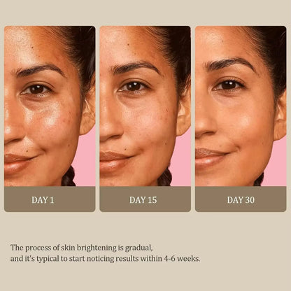 SkinGlow™ Kojic Turmeric Soap Bar